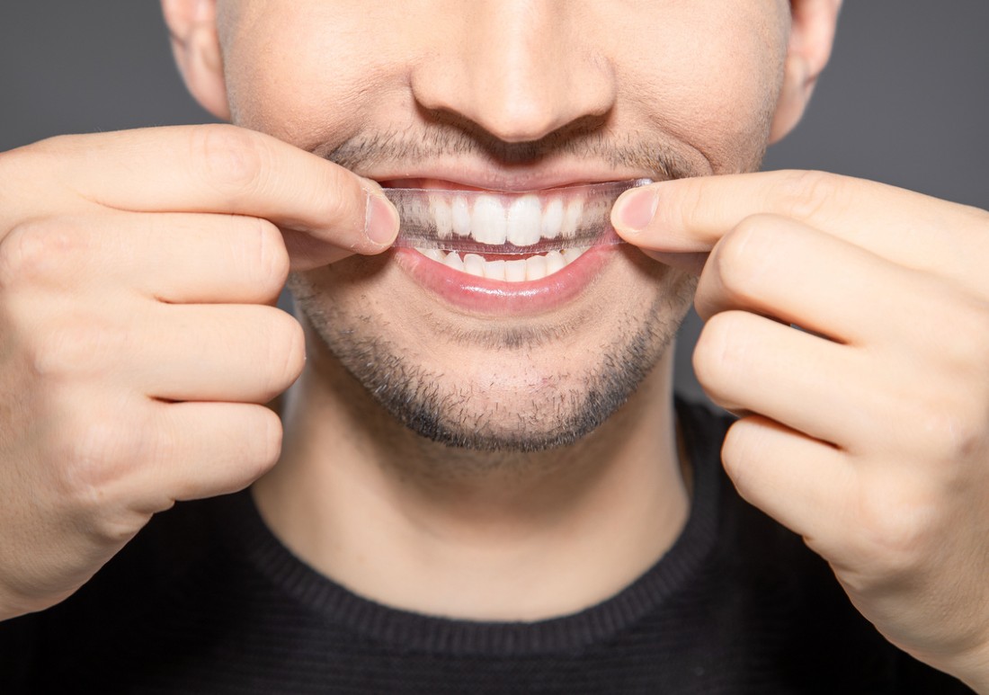 teeth whitening strips